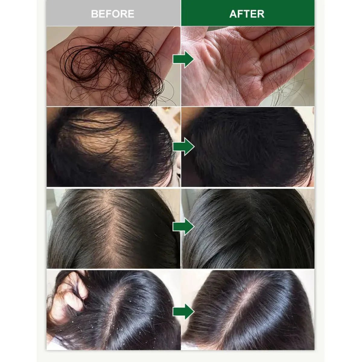 Hair Growth Essential Oil - COZYMAZE